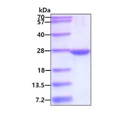 SDS-PAGE: Recombinant Human RAB22A His Protein [NBP1-72452]